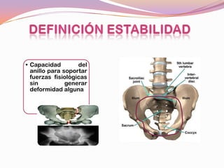 • Capacidad        del
  anillo para soportar
  fuerzas fisiológicas
  sin          generar
  deformidad alguna
 