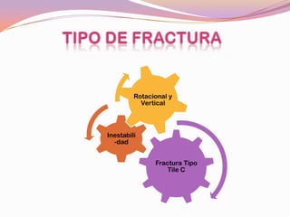 Rotacional y
           Vertical




Inestabili
  -dad


               Fractura Tipo
                   Tile C
 