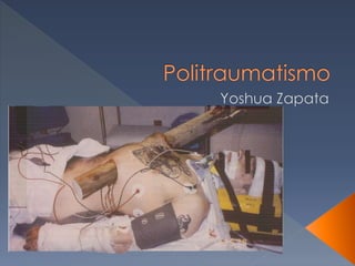 Politraumatismo