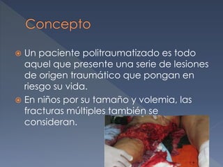  Un paciente politraumatizado es todo
aquel que presente una serie de lesiones
de origen traumático que pongan en
riesgo su vida.
 En niños por su tamaño y volemia, las
fracturas múltiples también se
consideran.
 