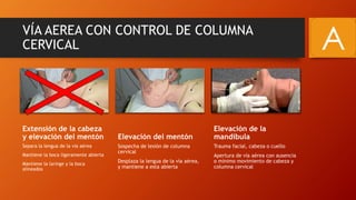 VÍA AEREA CON CONTROL DE COLUMNA
CERVICAL
Extensión de la cabeza
y elevación del mentón
Separa la lengua de la vía aérea
Mantiene la boca ligeramente abierta
Mantiene la laringe y la boca
alineados
Elevación del mentón
Sospecha de lesión de columna
cervical
Desplaza la lengua de la vía aérea,
y mantiene a esta abierta
Elevación de la
mandíbula
Trauma facial, cabeza o cuello
Apertura de vía aérea con ausencia
o mínimo movimiento de cabeza y
columna cervical
A
 