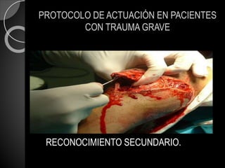 PROTOCOLO DE ACTUACIÓN EN PACIENTES
CON TRAUMA GRAVE
RECONOCIMIENTO SECUNDARIO.
 