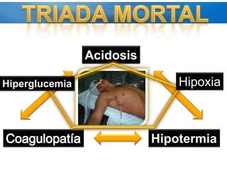Recrea trasfusión de sangre total 