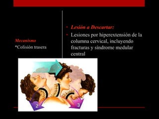 Lesión a Descartar: Lesiones por hiperextensión de la columna cervical, incluyendo fracturas y síndrome medular centralMecanismo*Colisión trasera