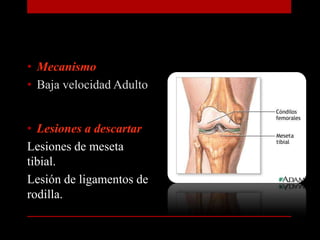 MecanismoBaja velocidad AdultoLesiones a descartar Lesiones de meseta tibial.Lesión de ligamentos de rodilla.