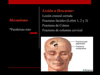 Lesión a Descartar: Lesión craneal cerrada Fracturas faciales (Lefort 1, 2 y 3)Fracturas de CráneoFracturas de columna cervicalMecanismo*Parabrisas roto 
