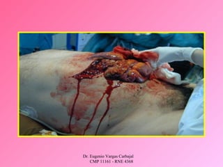 Dr. Eugenio Vargas Carbajal
CMP 11161 - RNE 4368
 