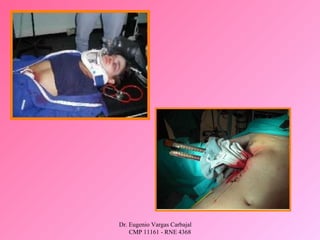 Dr. Eugenio Vargas Carbajal
CMP 11161 - RNE 4368
 