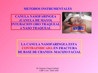 Dr. Eugenio Vargas Carbajal
CMP 11161 - RNE 4368
METODOS INSTRUMENTALES
CANULA NASOFARINGEA
(CANULA DE MAYO)
INTUBACION ORO TRAQUEAL
ó NASO TRAQUEAL
LA CANULA NASOFARINGEA ESTA
CONTRAINDICADA EN FRACTURA
DE BASE DE CRANEO- MACIZO FACIAL
AMBU
 