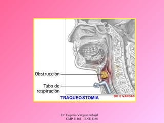 Dr. Eugenio Vargas Carbajal
CMP 11161 - RNE 4368
 