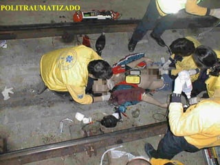 POLITRAUMATIZADO
 