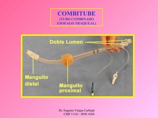 Dr. Eugenio Vargas Carbajal
CMP 11161 - RNE 4368
COMBITUBE
(TUBO COMBINADO
ESOFAGO TRAQUEAL)
 