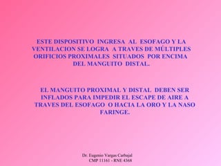 Dr. Eugenio Vargas Carbajal
CMP 11161 - RNE 4368
ESTE DISPOSITIVO INGRESA AL ESOFAGO Y LA
VENTILACION SE LOGRA A TRAVES DE MÚLTIPLES
ORIFICIOS PROXIMALES SITUADOS POR ENCIMA
DEL MANGUITO DISTAL.
EL MANGUITO PROXIMAL Y DISTAL DEBEN SER
INFLADOS PARA IMPEDIR EL ESCAPE DE AIRE A
TRAVES DEL ESOFAGO O HACIA LA ORO Y LA NASO
FARINGE.
 