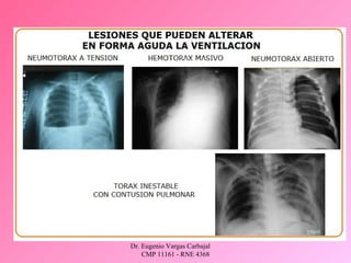 Dr. Eugenio Vargas Carbajal
CMP 11161 - RNE 4368
 