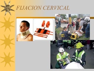 FIJACION CERVICAL 