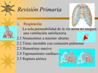 Revisión Primaria Respiración La sola permeabilidad de la vía aérea no asegura una ventilación satisfactoria 2.1 Neumotórax a tensión/ abierto 2.2 Tórax inestable con contusión pulmonar 2.3 Hemotórax masivo 2.4 Taponamiento cardiaco 2.5 Ruptura aórtica 