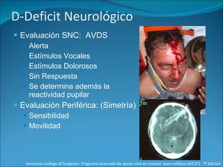 D-Deficit Neurológico Evaluación SNC:  AVDS Alerta Estímulos Vocales Estímulos Dolorosos Sin Respuesta Se determina además la reactividad pupilar Evaluación Periférica: (Simetría) Sensibilidad Movilidad American College of Surgeons. Programa avanzado de apoyo vital en trauma ®  para médicos (ATLS ® ).  7ª Edición 