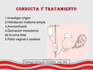 CoNduCtA y trAtAmIeNto
1.Investigar origen
2.Hidratación materna simple.
3.Amnioinfusión
4.Derivación intrauterina
de la orina fetal.
5.Parto vaginal o cesárea
Patología del líquido Amniótico. Juan Aller
 