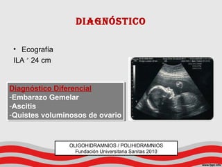 DiagnóstiCo
• Ecografía
ILA 24 cm˃
Diagnóstico Diferencial
-Embarazo Gemelar
-Ascitis
-Quistes voluminosos de ovario
Diagnóstico Diferencial
-Embarazo Gemelar
-Ascitis
-Quistes voluminosos de ovario
OLIGOHIDRAMNIOS / POLIHIDRAMNIOS
Fundación Universitaria Sanitas 2010
 