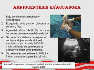 amnioCEntEsis EvaCuaDora
1. Bajo condiciones asépticas y
antisépticas,
2. Ecoguiada: evita punción placentaria,
cordón y feto.
3. Aguja del calibre 14- 18 :Se punza en
las zonas de ventana máxima de LA
4. Se conecta a sistema de aspiración
continua dejando salir el líquido
amniótico a un ritmo de 500-700
ml./h. aliviando de este modo la
disnea y el dolor de la paciente.
5. Se detiene el procedimiento VMLA <
7-6cm o cuando supere los 25 min.
Amniodrenaje en el manejo del polihidramnios severo sintomático
España 2013
 