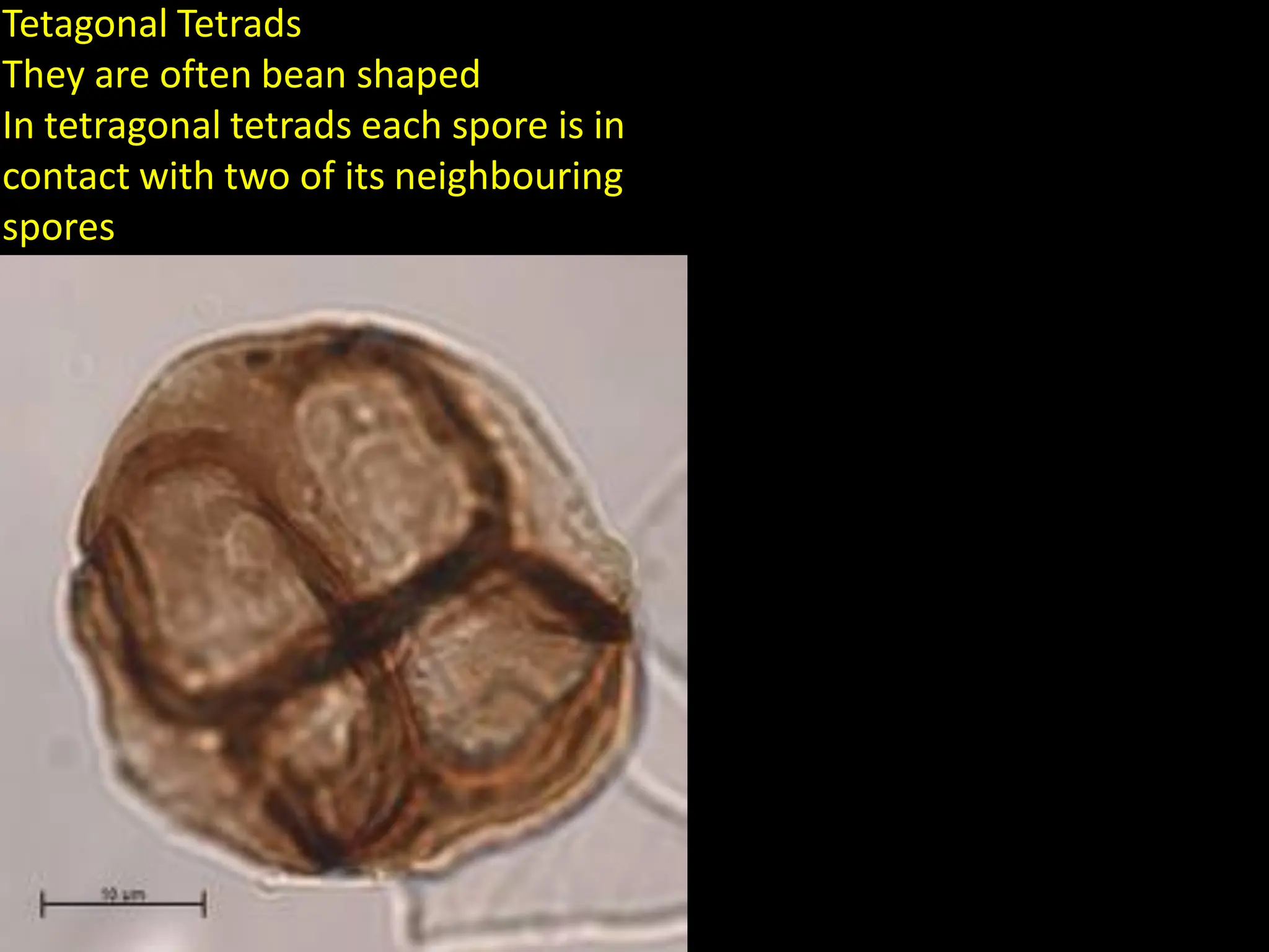 Tetagonal Tetrads
They are often bean shaped
In tetragonal tetrads each spore is in
contact with two of its neighbouring
spores
 