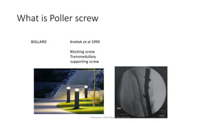 What is Poller screw
BOLLARD Krettek et al 1999
Blocking screw
Transmedullary
supporting screw
Traumacon 2022 Nepal Tibia Nailing
 
