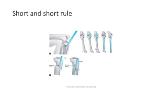 Short and short rule
Traumacon 2022 Nepal Tibia Nailing
 