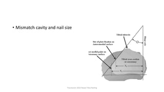 • Mismatch cavity and nail size
Traumacon 2022 Nepal Tibia Nailing
 