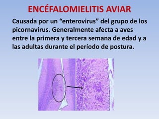 ENCÉFALOMIELITIS AVIAR 
Causada por un “enterovirus” del grupo de los 
picornavirus. Generalmente afecta a aves 
entre la primera y tercera semana de edad y a 
las adultas durante el período de postura. 
 