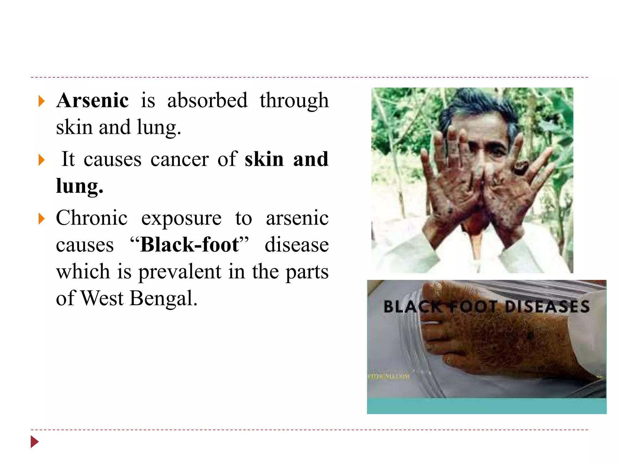  Arsenic is absorbed through
skin and lung.
 It causes cancer of skin and
lung.
 Chronic exposure to arsenic
causes “Black-foot” disease
which is prevalent in the parts
of West Bengal.
 