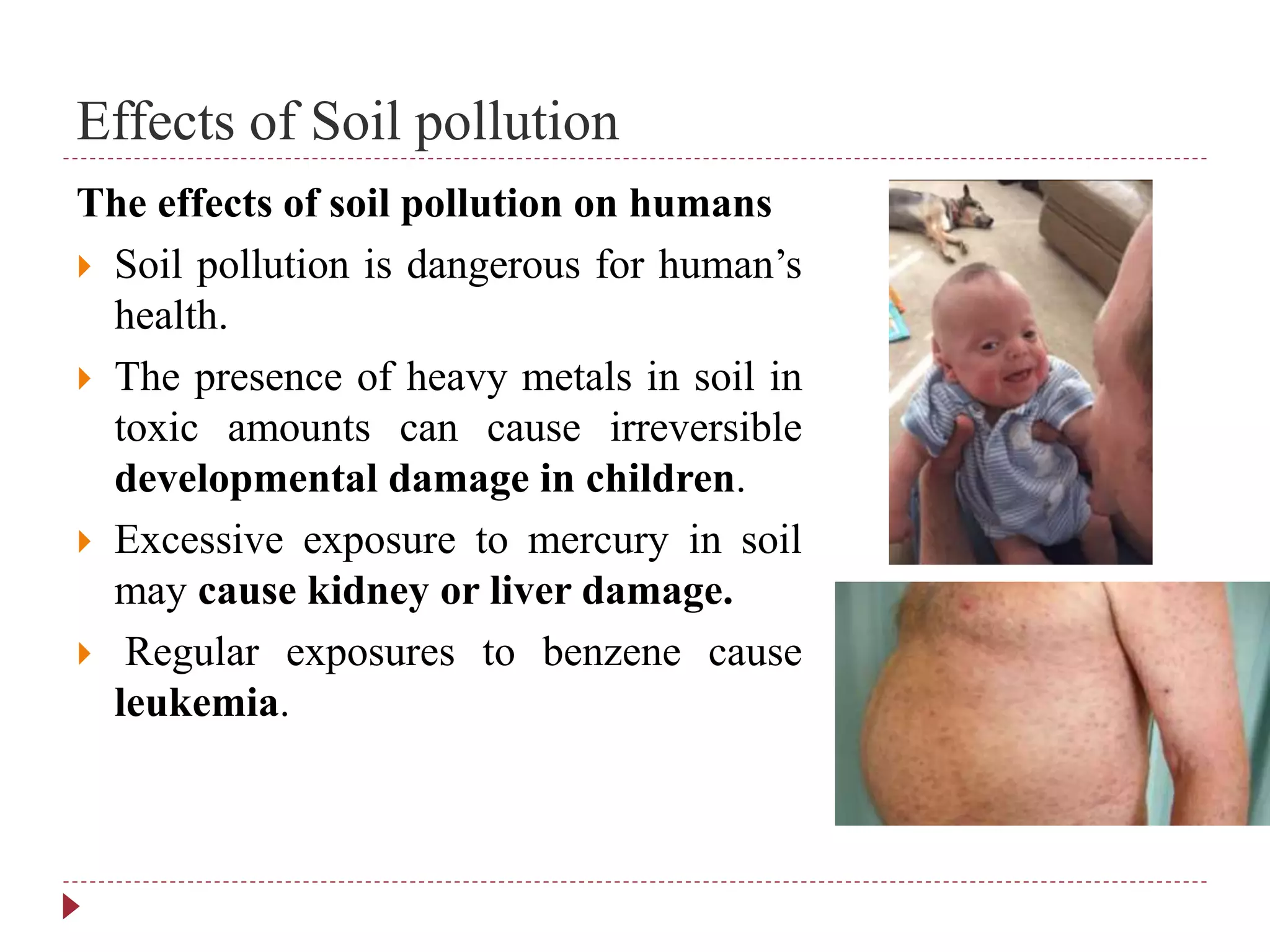 Effects of Soil pollution
The effects of soil pollution on humans
 Soil pollution is dangerous for human’s
health.
 The presence of heavy metals in soil in
toxic amounts can cause irreversible
developmental damage in children.
 Excessive exposure to mercury in soil
may cause kidney or liver damage.
 Regular exposures to benzene cause
leukemia.
 