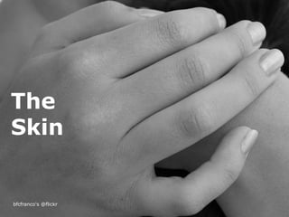 The
Skin


bfcfranco's @flickr
 