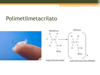 Polimetilmetacrilato
 