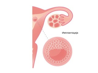 Имплантација
 
