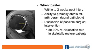 • When to refer
– Within to 2 weeks post injury
– Ability to promptly obtain MR
arthrogram (labral pathology)
– Discussion of possible surgical
intervention
• 50-90% re-dislocation rate
in skeletally mature patients
 