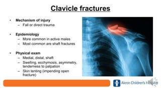 Clavicle fractures
• Mechanism of injury
– Fall or direct trauma
• Epidemiology
– More common in active males
– Most common are shaft fractures
• Physical exam
– Medial, distal, shaft
– Swelling, ecchymosis, asymmetry,
tenderness to palpation
– Skin tenting (impending open
fracture)
 