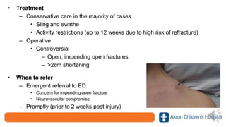 • Treatment
– Conservative care in the majority of cases
• Sling and swathe
• Activity restrictions (up to 12 weeks due to high risk of refracture)
– Operative
• Controversial
– Open, impending open fractures
– >2cm shortening
• When to refer
– Emergent referral to ED
• Concern for impending open fracture
• Neurovascular compromise
– Promptly (prior to 2 weeks post injury)
 