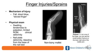 Finger Injuries/Sprains
• Mechanism of Injury
– Fall, direct blow,
“stoved finger”
• Physical exam
– Swelling,
tenderness to
palpation, limited
ROM, clinical
deformity
– Nail plate
deformity, bleeding
from the base of
the nail bed
Non-bony mallet
 