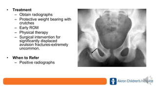 • Treatment
– Obtain radiographs
– Protective weight bearing with
crutches
– Early ROM
– Physical therapy
– Surgical intervention for
significantly displaced
avulsion fractures-extremely
uncommon.
• When to Refer
– Positive radiographs
 