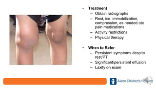 • Treatment
– Obtain radiographs
– Rest, ice, immobilization,
compression, as needed otc
pain medications
– Activity restrictions
– Physical therapy
• When to Refer
– Persistent symptoms despite
rest/PT
– Significant/persistent effusion
– Laxity on exam
 