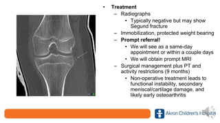 • Treatment
– Radiographs
• Typically negative but may show
Segund fracture
– Immobilization, protected weight bearing
– Prompt referral!
• We will see as a same-day
appointment or within a couple days
• We will obtain prompt MRI
– Surgical management plus PT and
activity restrictions (9 months)
• Non-operative treatment leads to
functional instability, secondary
meniscal/cartilage damage, and
likely early osteoarthritis
 