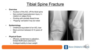 Tibial Spine Fracture
• Overview
– Avulsion of the ACL off the tibial spine
– Non-contact hyperextension injury +/-
rotation or valgus force
– Pivoting with partially flexed knee
– “Popping” sensation may be noted
• Epidemiology
– Childhood equivalent of an ACL tear
– Most common between 8-14 years of
age
• Physical Exam
– Effusion, tenderness to palpation,
limited ROM (lack extension)
– Antalgia/inability to bear weight
 