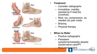 • Treatment
– Consider radiographs
– Immobilize, mobility
assistance if need be
(crutches)
– Rest, ice, compression, as
needed otc pain meds
– Bracing
– Physical therapy
• When to Refer
– Positive radiographs
– Persistent
symptoms/instability despite
conservative care/PT
– Recurrent sprains
 