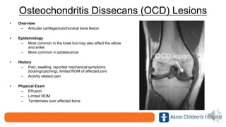 Osteochondritis Dissecans (OCD) Lesions
• Overview
– Articular cartilage/subchondral bone lesion
• Epidemiology
– Most common in the knee but may also affect the elbow
and ankle
– More common in adolescence
• History
– Pain, swelling, reported mechanical symptoms
(locking/catching), limited ROM of affected joint
– Activity related pain
• Physical Exam
– Effusion
– Limited ROM
– Tenderness over affected bone
 