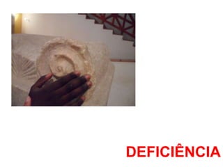 DEFICIÊNCIA
 