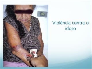 Violência contra o
      idoso
 