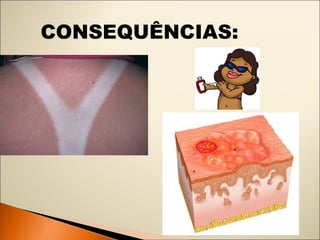 CONSEQUÊNCIAS: 
 