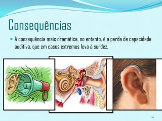O que é a Poluição Sonora ?A poluição sonora acontece quando no ambiente onde nos encontramos, o nível de som é demasiado alto e provoca dor. Embora esta poluição não se junte no meio ambiente, provoca tal como outros tipos de poluição, danos no corpo (sistema auditivo) e na qualidade de vida das pessoas.4