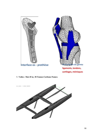 98
5- Voiles : Mat 45 m, 30 Tonnes Carbone-Nomex
Articulation du genou
ligaments, tendons,
cartilages, ménisques
Interface os - prothèse
 