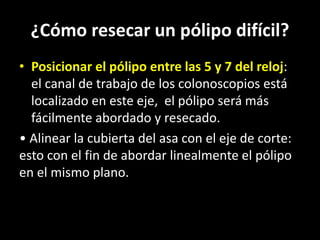 ¿Cómo resecar un pólipo difícil?
• Posicionar el pólipo entre las 5 y 7 del reloj:
el canal de trabajo de los colonoscopios está
localizado en este eje, el pólipo será más
fácilmente abordado y resecado.
• Alinear la cubierta del asa con el eje de corte:
esto con el fin de abordar linealmente el pólipo
en el mismo plano.
 